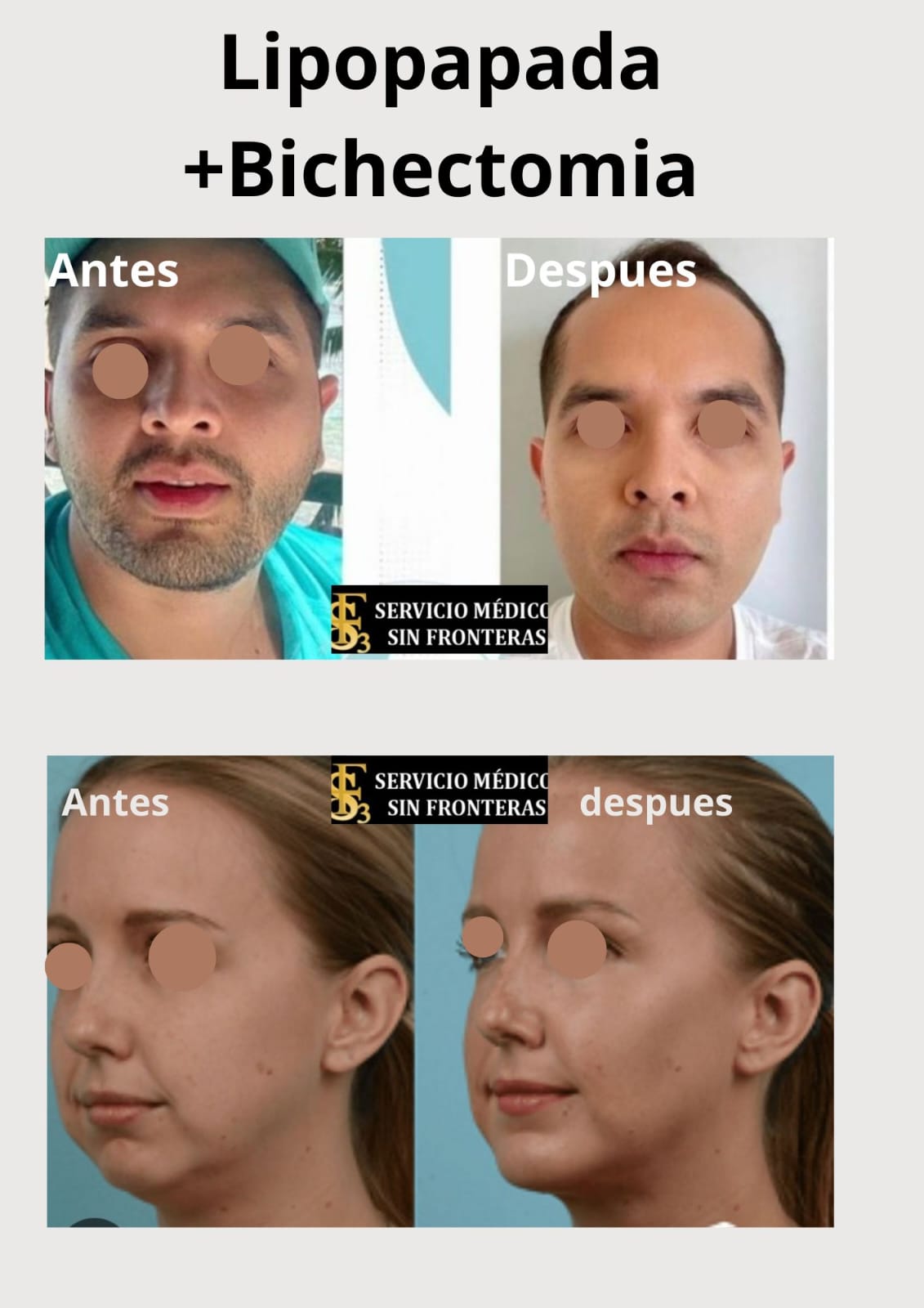 Resultado Lipopapada 1